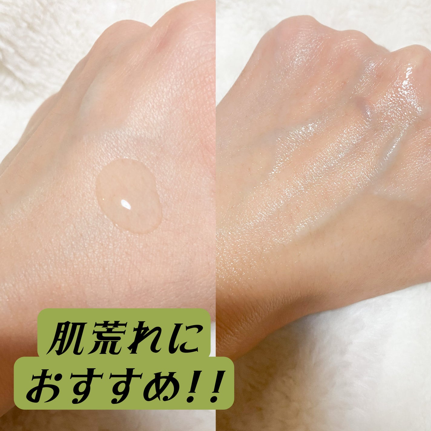 ノスカナイン トラブル セラム/FATION/美容液を使ったクチコミ(2枚目)