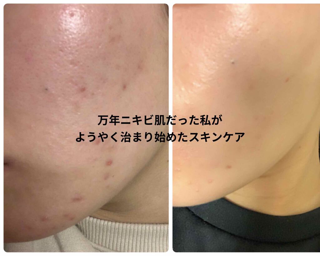 スパ・エ・メール ブラン コンフォール ミルク/Prédia/乳液を使ったクチコミ（1枚目）