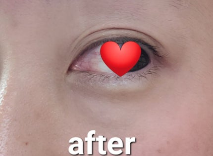 アイレノール クマクリーム/IRENOL/アイケア・アイクリームを使ったクチコミ(4枚目)