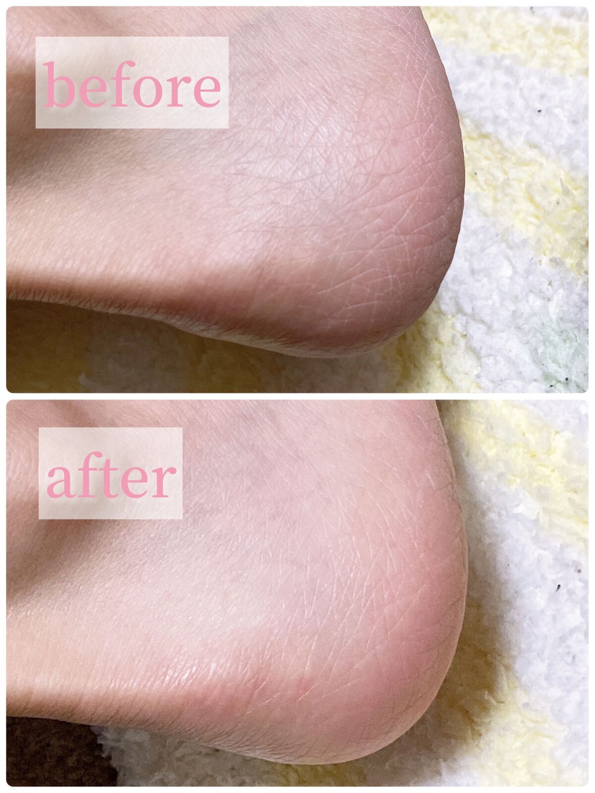 なめらかかとスティック/小林製薬/レッグ・フットケアを使ったクチコミ（3枚目）