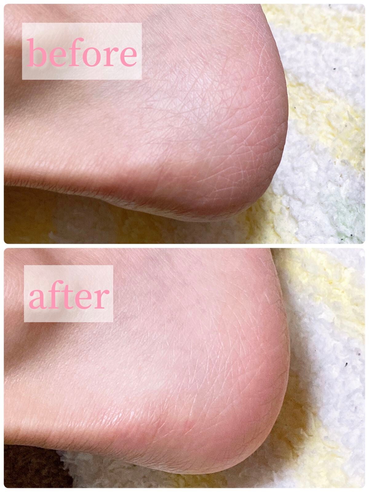 なめらかかとスティック/小林製薬/レッグ・フットケアを使ったクチコミ(3枚目)