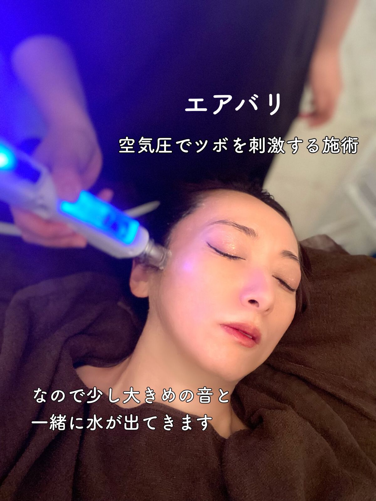 エミリー@フォロバ100 on LIPS 「・・エアバリって聞いたことある?エアバリとは、鍼を刺さない美容..」(5枚目)