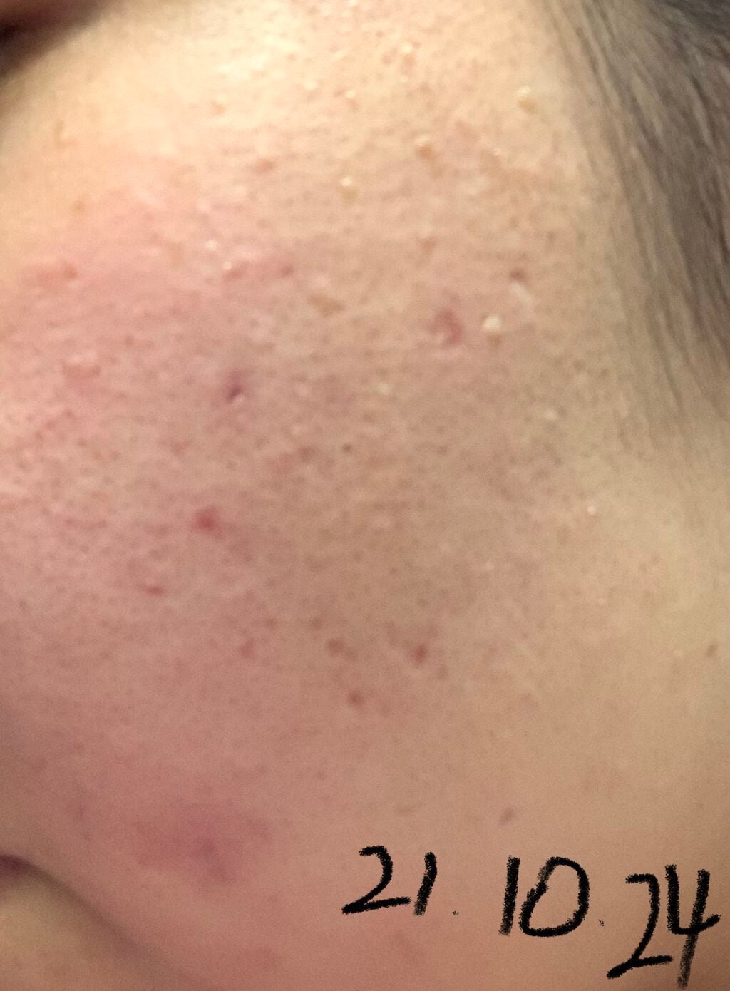 クリアウォッシュ/オルビス/洗顔フォームを使ったクチコミ(4枚目)