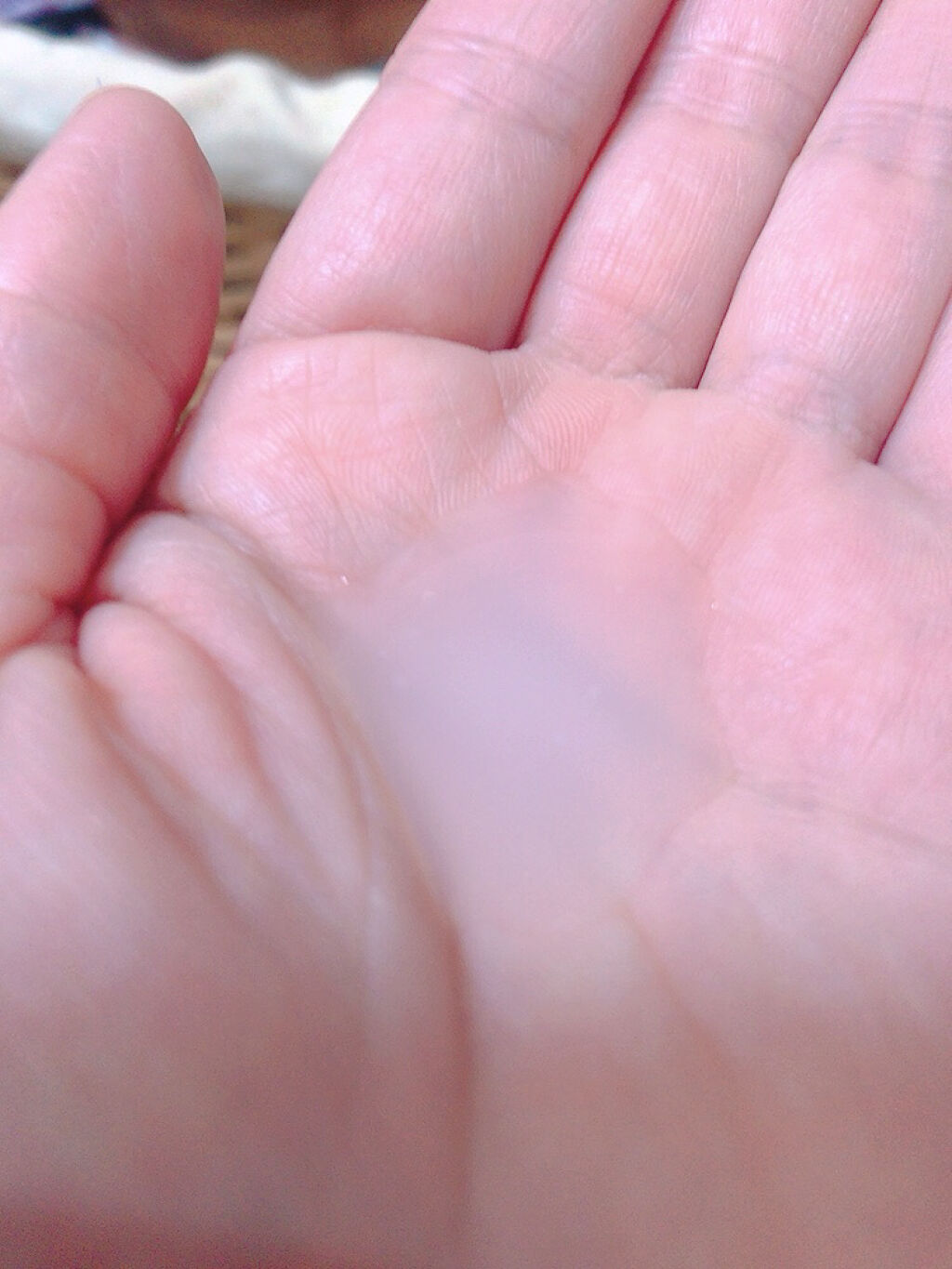 モイスチュア ローション/カルテHD/化粧水を使ったクチコミ（2枚目）