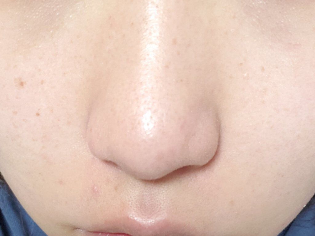 シンクロスキン ラディアントリフティング ファンデーション 160 Shell/SHISEIDO/リキッドファンデーションを使ったクチコミ（3枚目）