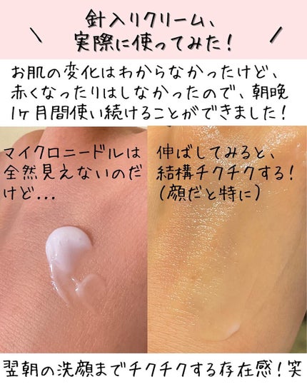 メディリフト ニードルリフトクリーム/YA-MAN TOKYO JAPAN/フェイスクリームを使ったクチコミ(4枚目)