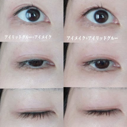 湘南美容アイリッドグルー/湘南美容/二重まぶた用アイテムを使ったクチコミ(9枚目)