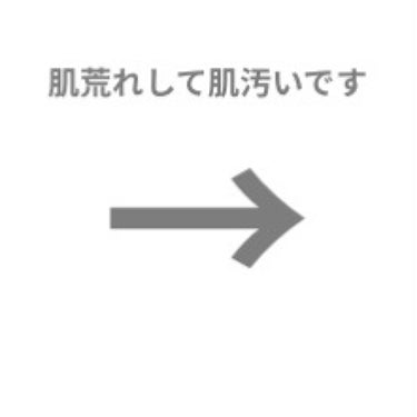 バスタイム除毛クリーム 敏感肌用/Veet/除毛クリームを使ったクチコミ（2枚目）