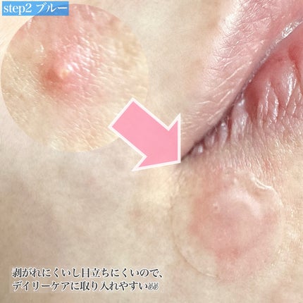 スポットイレイザー/NOLAHOUR/その他スキンケアを使ったクチコミ(5枚目)