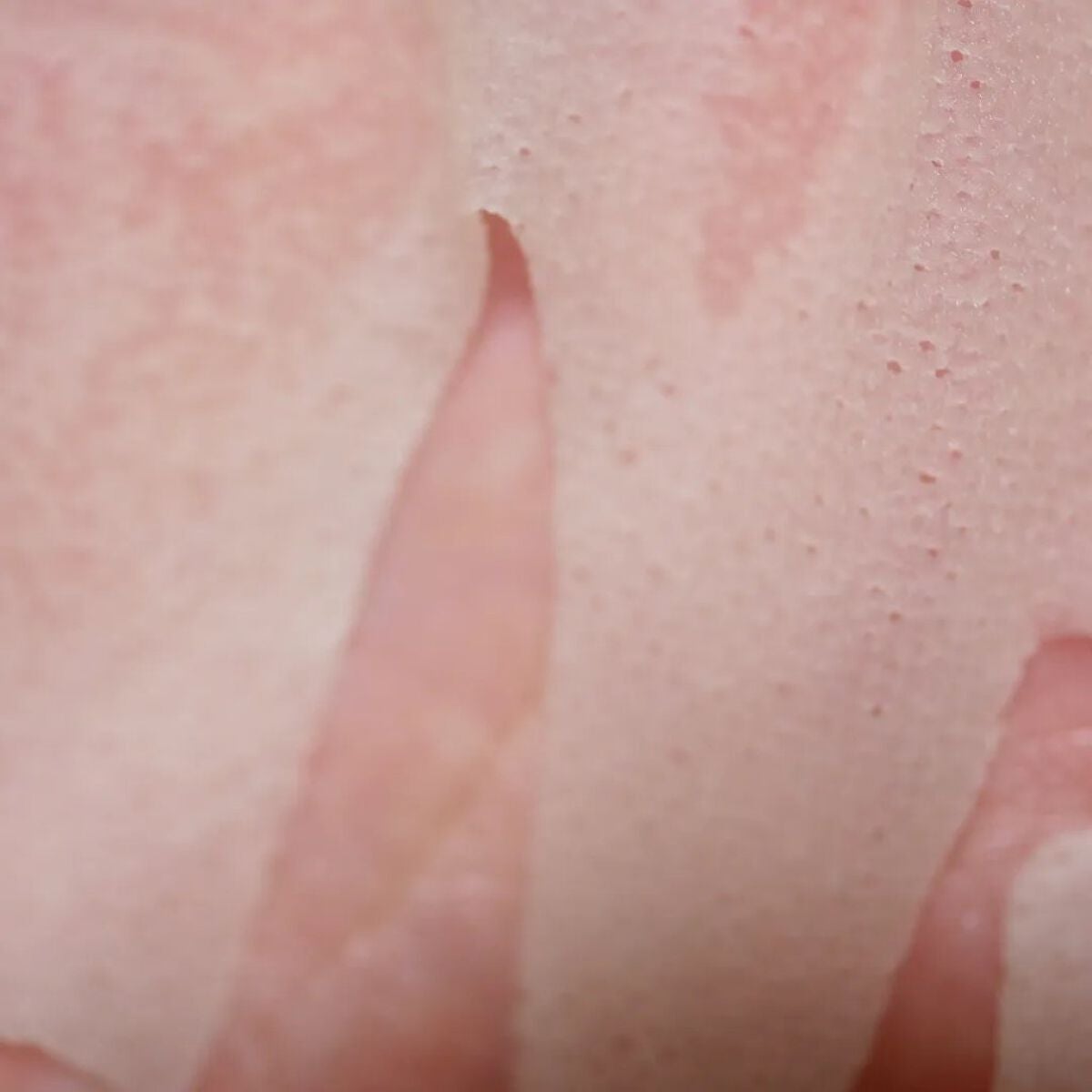 スキントラブルケア マスク/アルージェ/シートマスク・パックを使ったクチコミ(2枚目)