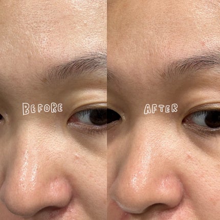 レチノール スーパーバウンス セラム/IOPE/美容液を使ったクチコミ(4枚目)