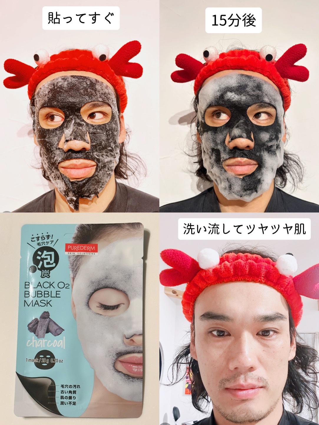 BLACK O2 泡パック charcoal /PUREDERM/シートマスク・パックを使ったクチコミ（3枚目）