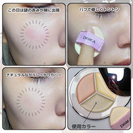 パーフェクトカバー コンシーラーパレット/Dear.A/パレットコンシーラーを使ったクチコミ(4枚目)