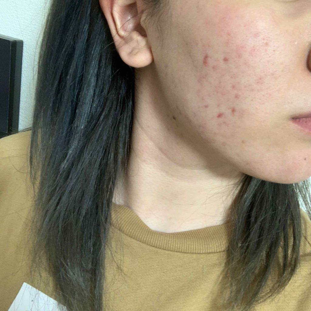 7 day Special Set プログラム3/b.glen/トライアルキットを使ったクチコミ(2枚目)