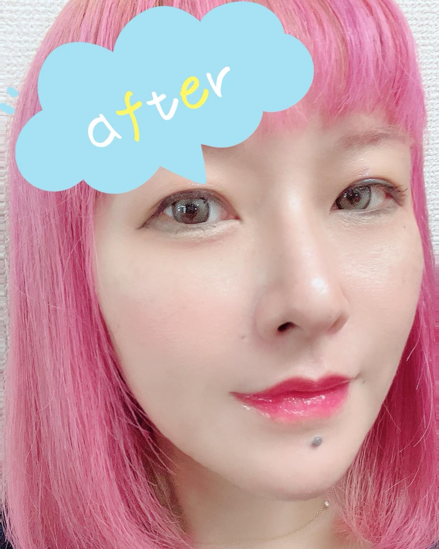 キューミ―ボムショットリッププランパー/AGARISM/リッププランパーを使ったクチコミ（3枚目）