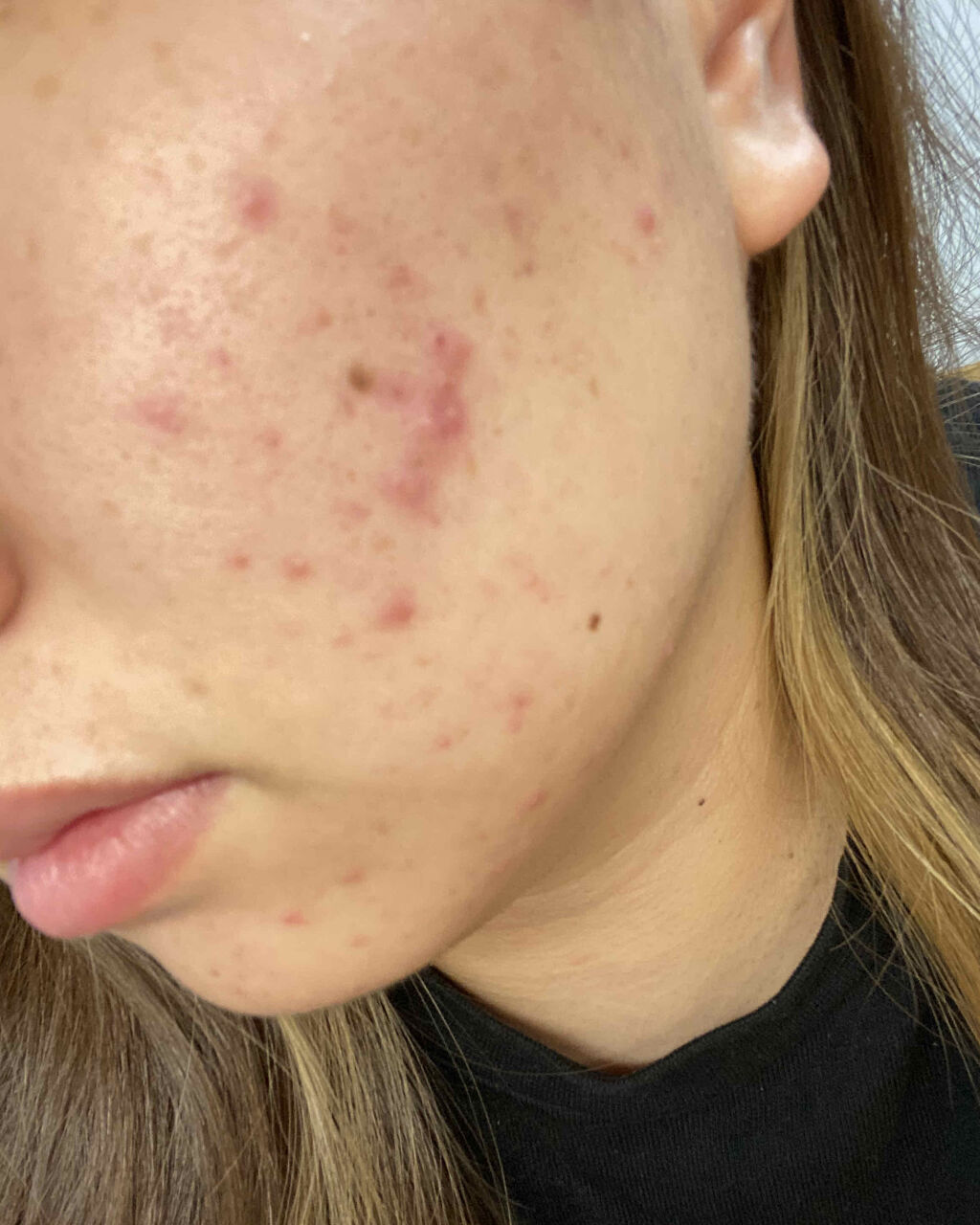 明色美顔水 薬用化粧水/美顔/化粧水を使ったクチコミ（3枚目）