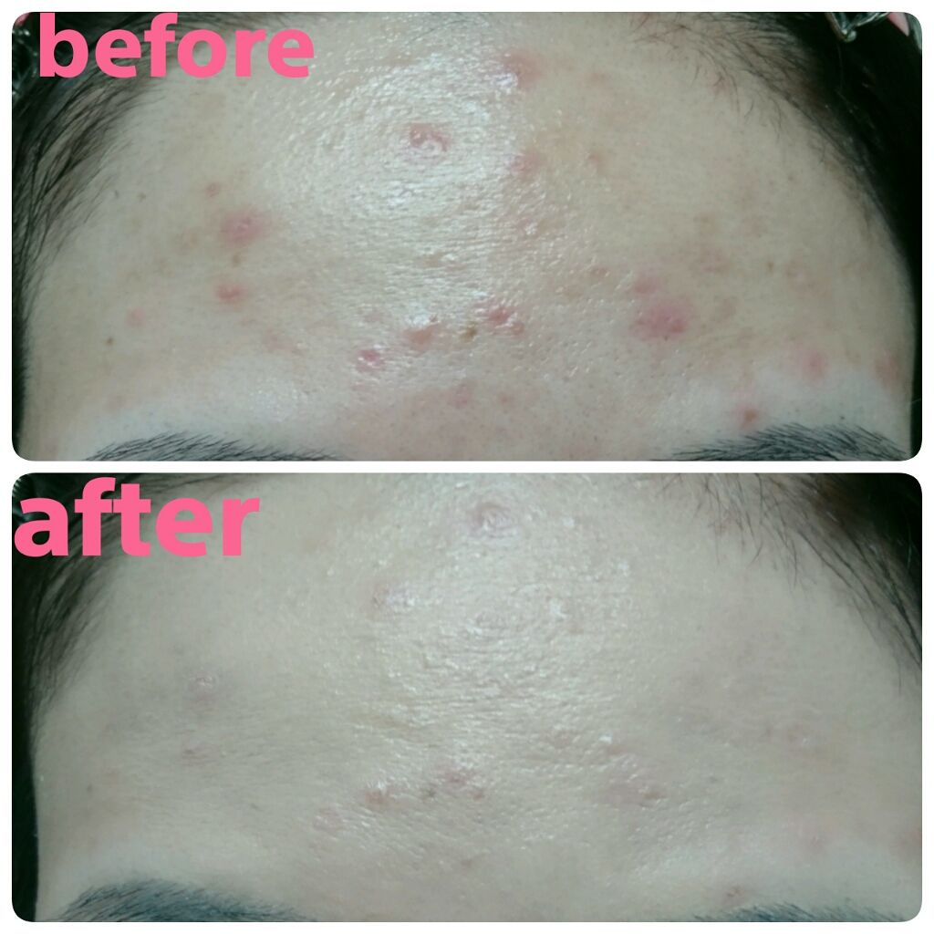 毛穴パテ職人 エッセンスBBクリーム ML(モイストリフト)のクチコミ「毛穴パテ職人、先日初めて使いました💕

今まで存在を知ってはいたものの、購入しなかったことを後.....」（3枚目）