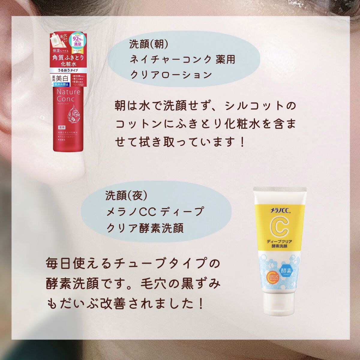 皮脂トラブルケア 化粧水/キュレル/化粧水を使ったクチコミ（2枚目）