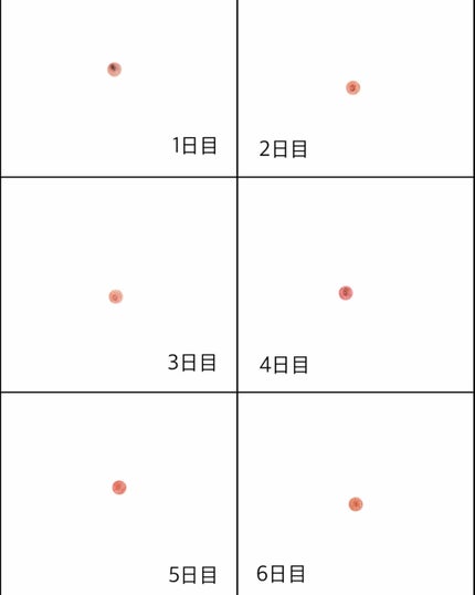 加香ひまし油(医薬品)/日本薬局方/その他を使ったクチコミ(2枚目)