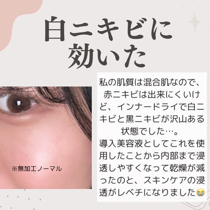 発酵導入美容液/無印良品/ブースター・導入液を使ったクチコミ(3枚目)