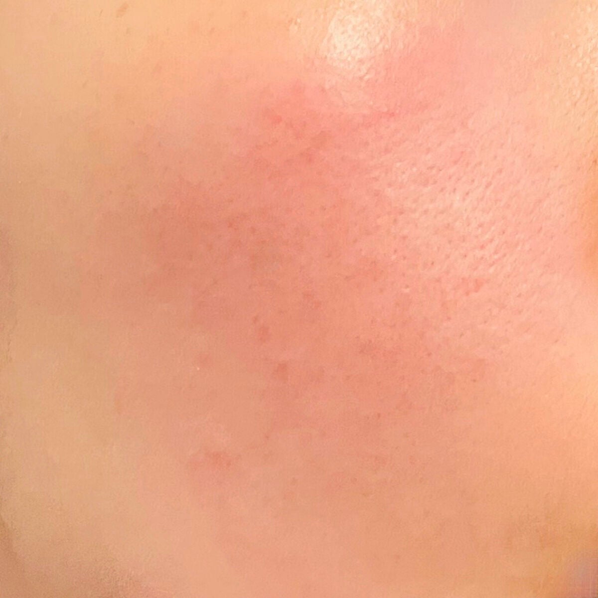 レチノール0.1%クリーム/Frankly/フェイスクリームを使ったクチコミ(2枚目)