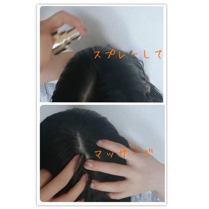 あたりちゃん♥️フォロバ&イイネ返し on LIPS 「抜け毛や分け目の髪の毛のボリュームが気になっていました🙄女性ホ..」(7枚目)