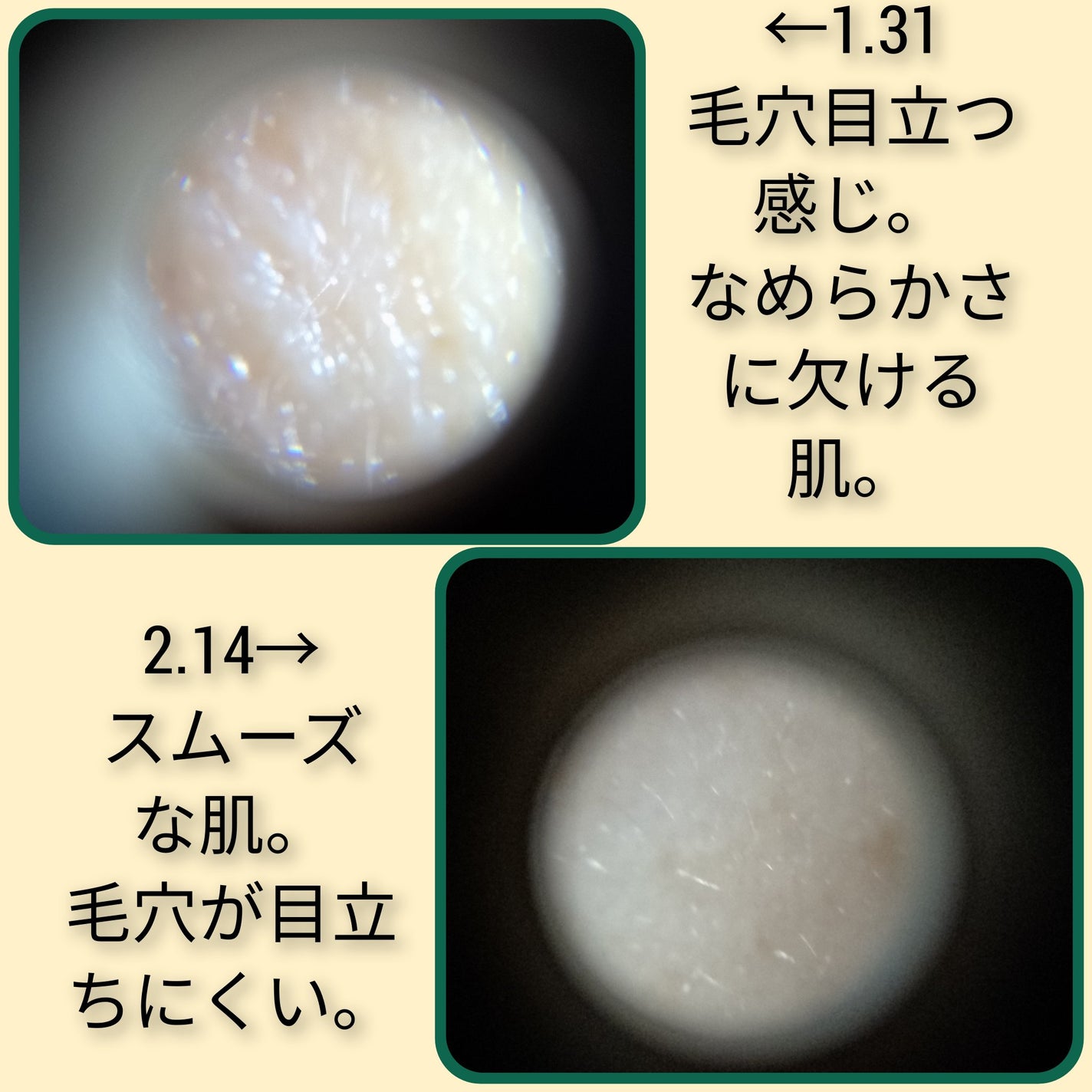 リードルショット100/VT/美容液を使ったクチコミ(5枚目)