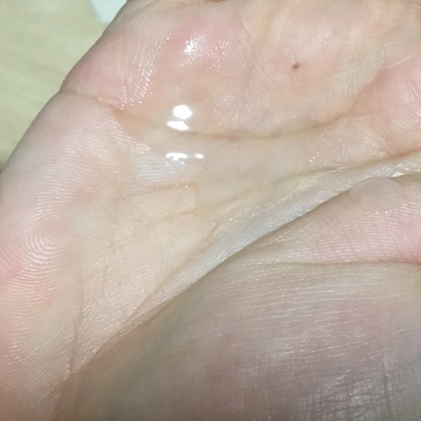 アクアヒアルロニックエッセンス/ロベクチン/化粧水を使ったクチコミ(3枚目)