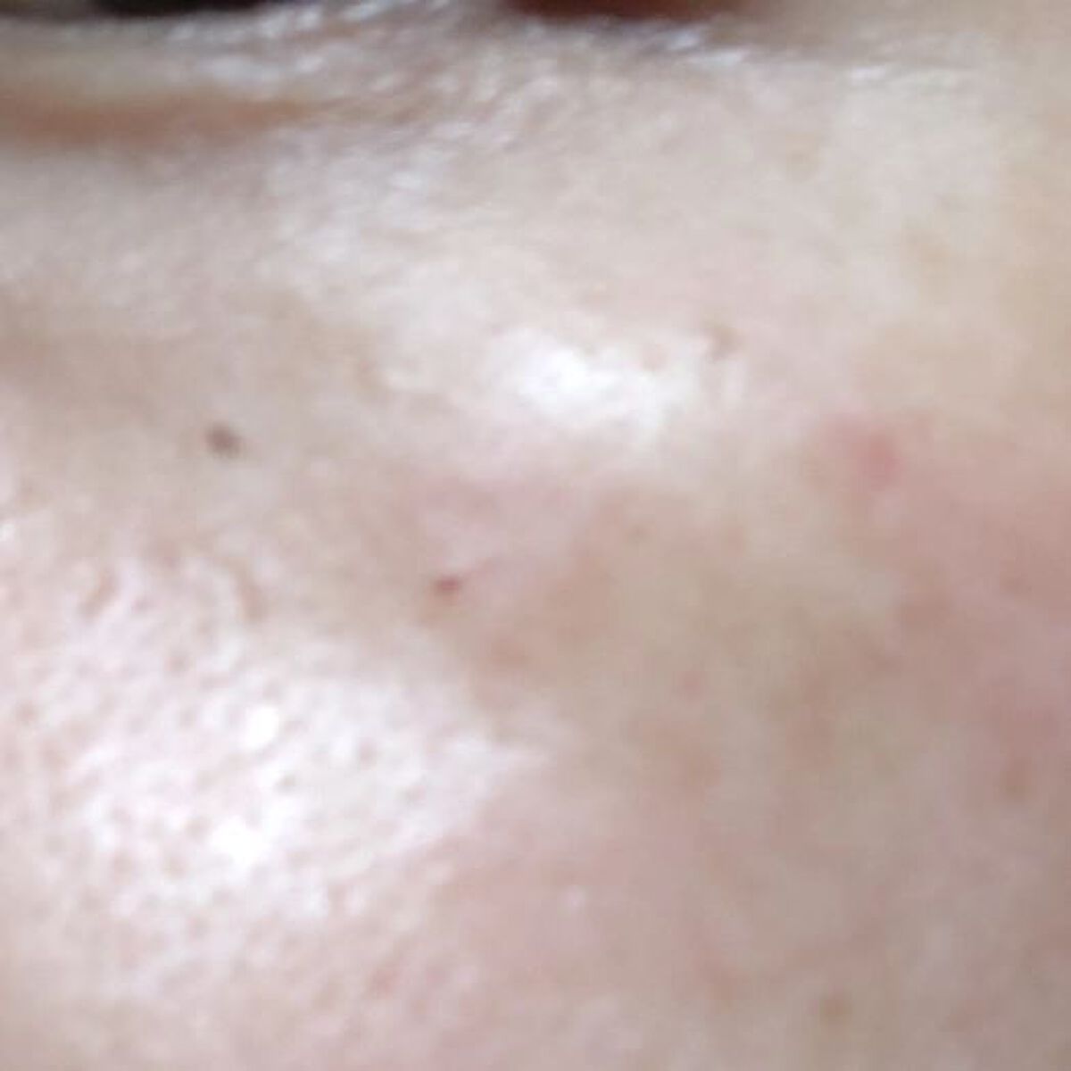 GOLD COLLAGEN DUAL EYE PATCH/SNP/アイケア・アイクリームを使ったクチコミ(2枚目)