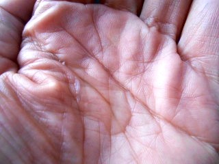 タカミスキンピール/タカミ/ブースター・導入液を使ったクチコミ（3枚目）