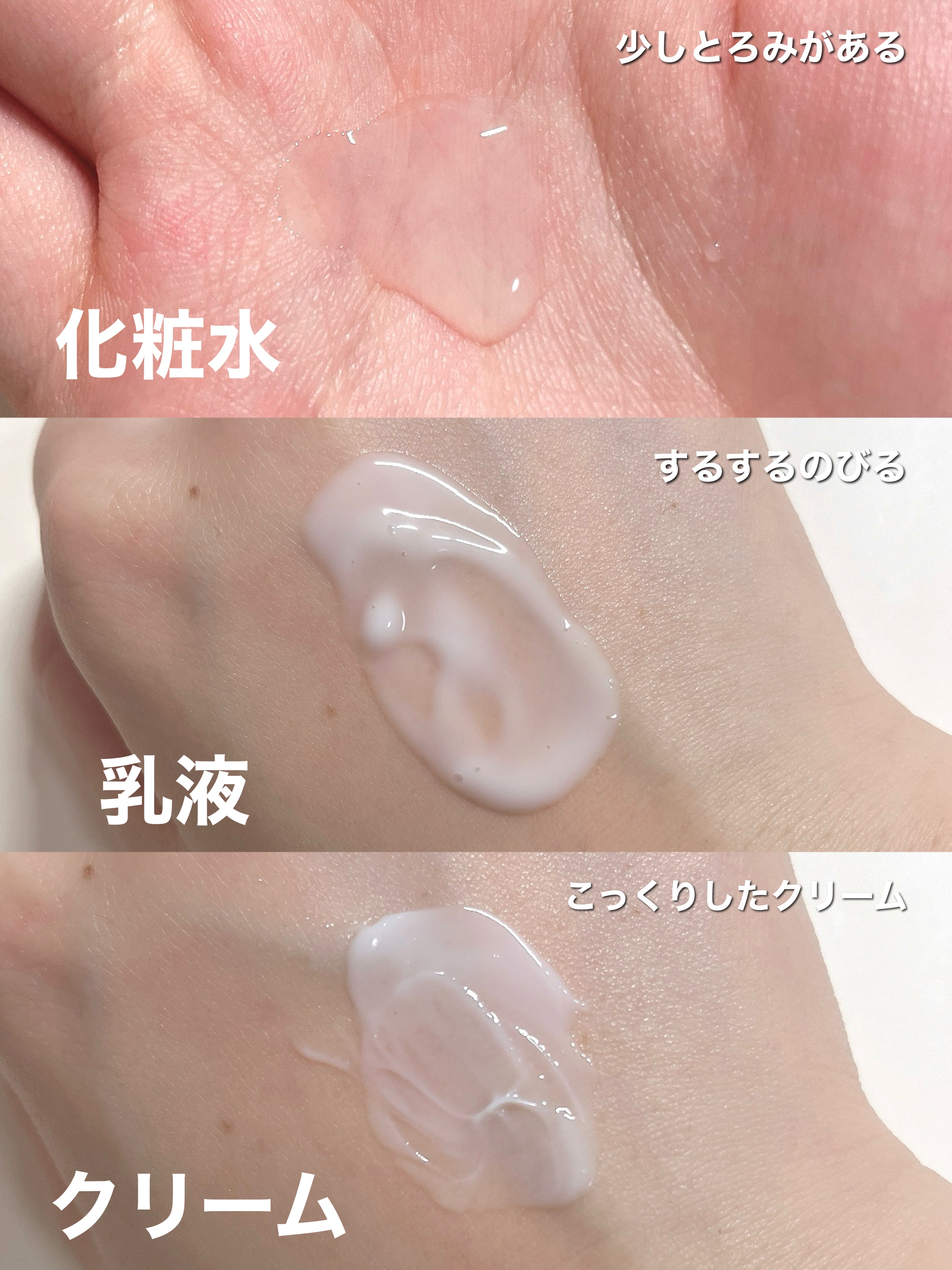 薬用高保湿化粧水/乾燥さん/化粧水を使ったクチコミ（2枚目）