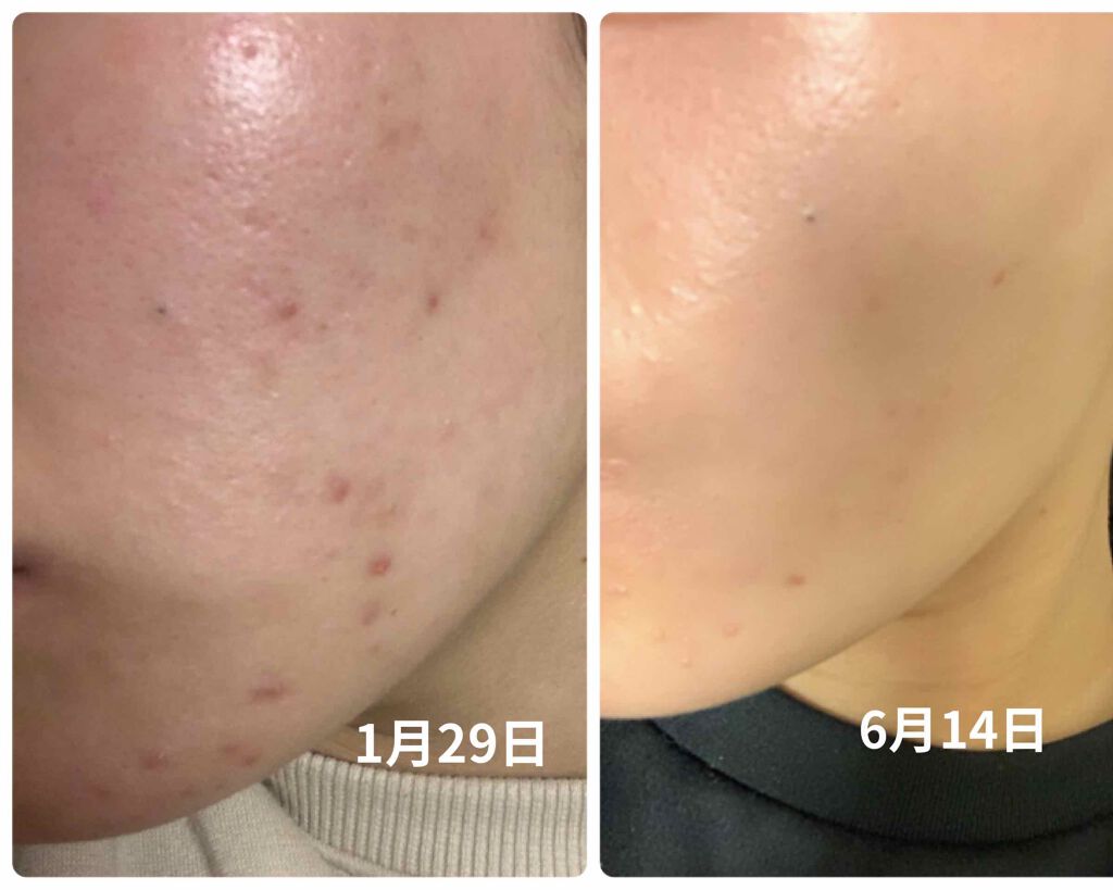 スパ・エ・メール ブラン コンフォール ミルク/Prédia/乳液を使ったクチコミ（2枚目）