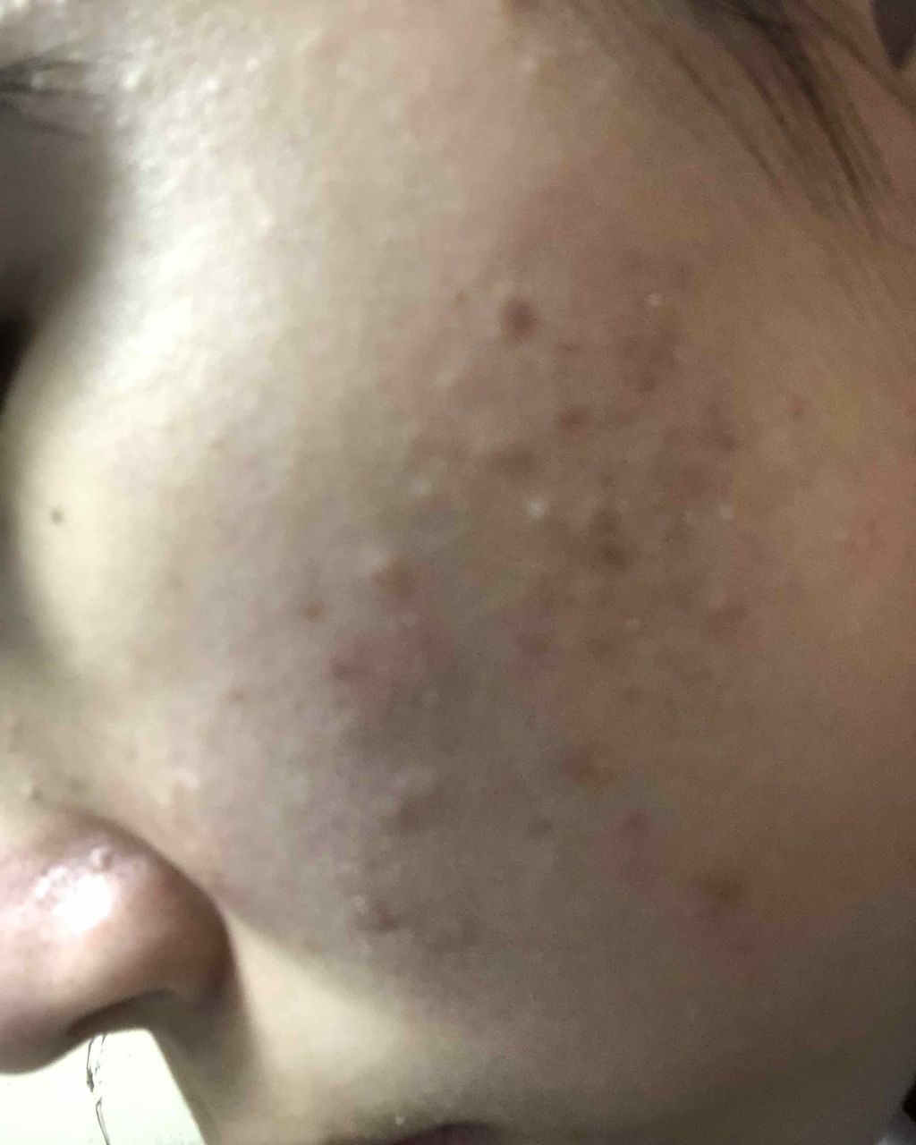 明色美顔水 薬用化粧水/美顔/化粧水を使ったクチコミ（3枚目）