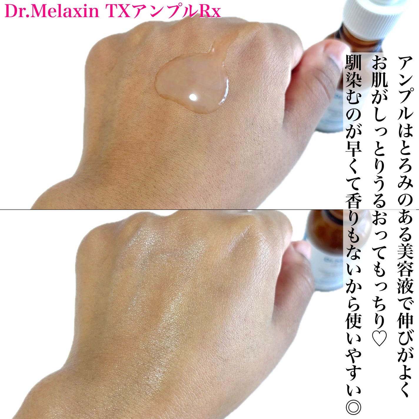 TX-Cream/Dr.Melaxin/フェイスクリームを使ったクチコミ(4枚目)