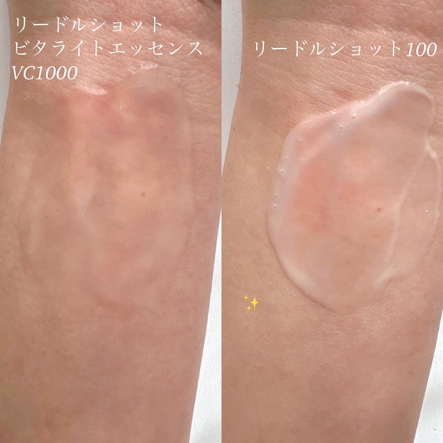 リードルショット100/VT/美容液を使ったクチコミ(2枚目)