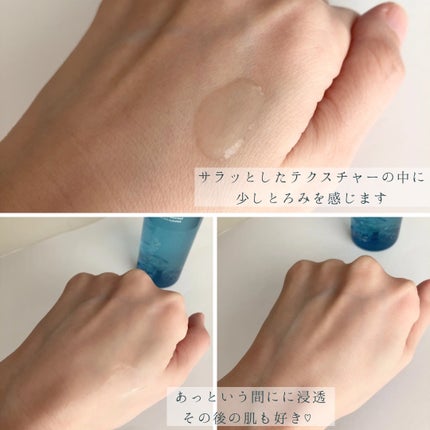 薬用マイクロバブルローション/Macchia Label/化粧水を使ったクチコミ(4枚目)