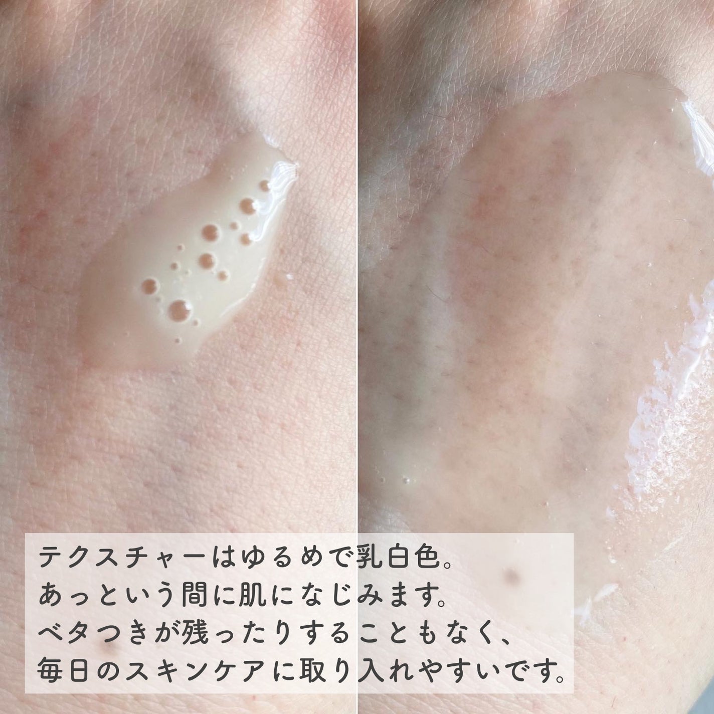 レチノール シカ リペア セラム/innisfree/美容液を使ったクチコミ(2枚目)