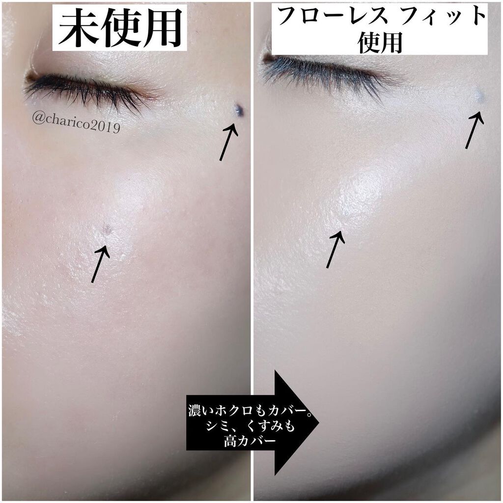 フローレス フィット/COVERMARK/クリーム・エマルジョンファンデーションを使ったクチコミ(3枚目)