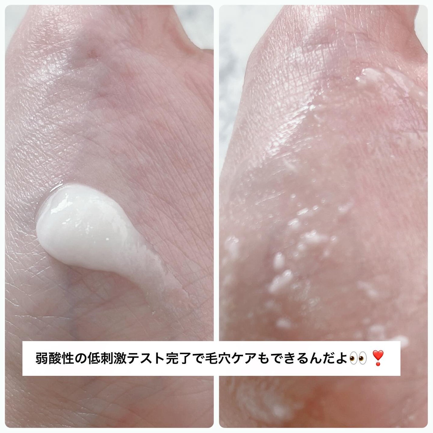 アルファ ナイアシン スムースピーリングジェル/ShionLe/ピーリングを使ったクチコミ(4枚目)