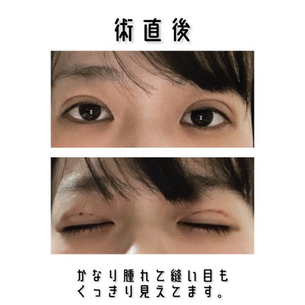 ããŒãã§ã¯ããã«ãã¢ã€ãº/ãã£ã³ã¡ã€ã¯/ã¢ã€ã·ã£ããŠãã¬ããã䜿ã£ãã¯ãã³ãïŒ3æç®ïŒ