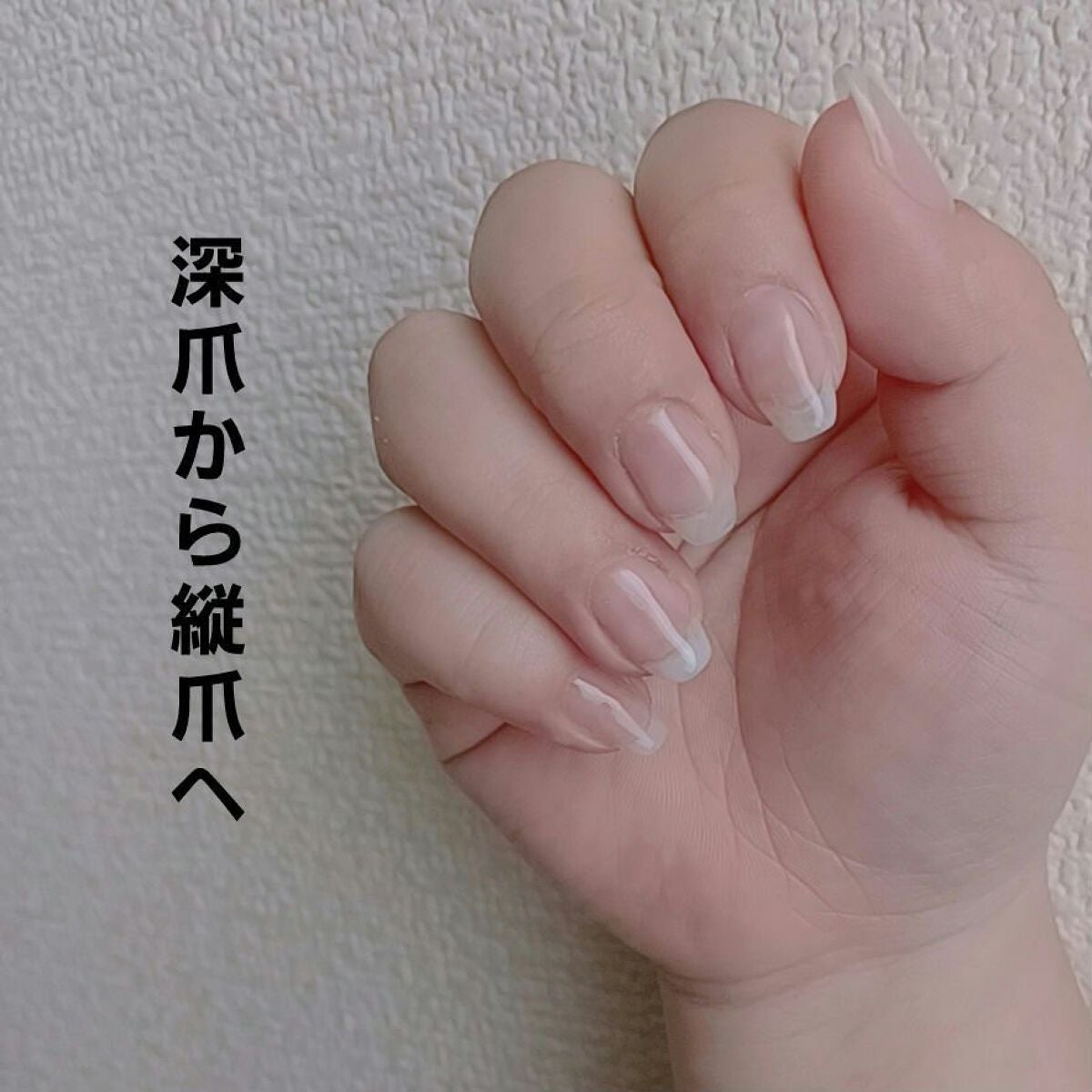 あさみん on LIPS 「去年同じような投稿しましたが、深爪に悩む方に届け〜〜〜♡わたし..」(1枚目)