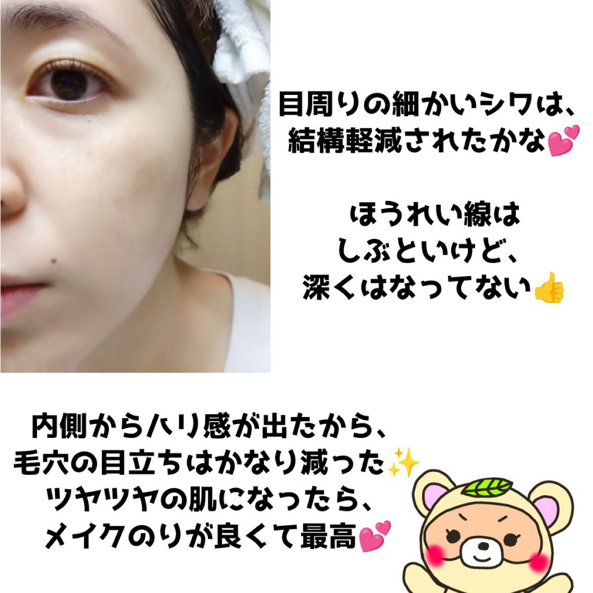 NMNモイストリペアバイオセルロースマスク/Natuore Recover/シートマスク・パックを使ったクチコミ（3枚目）