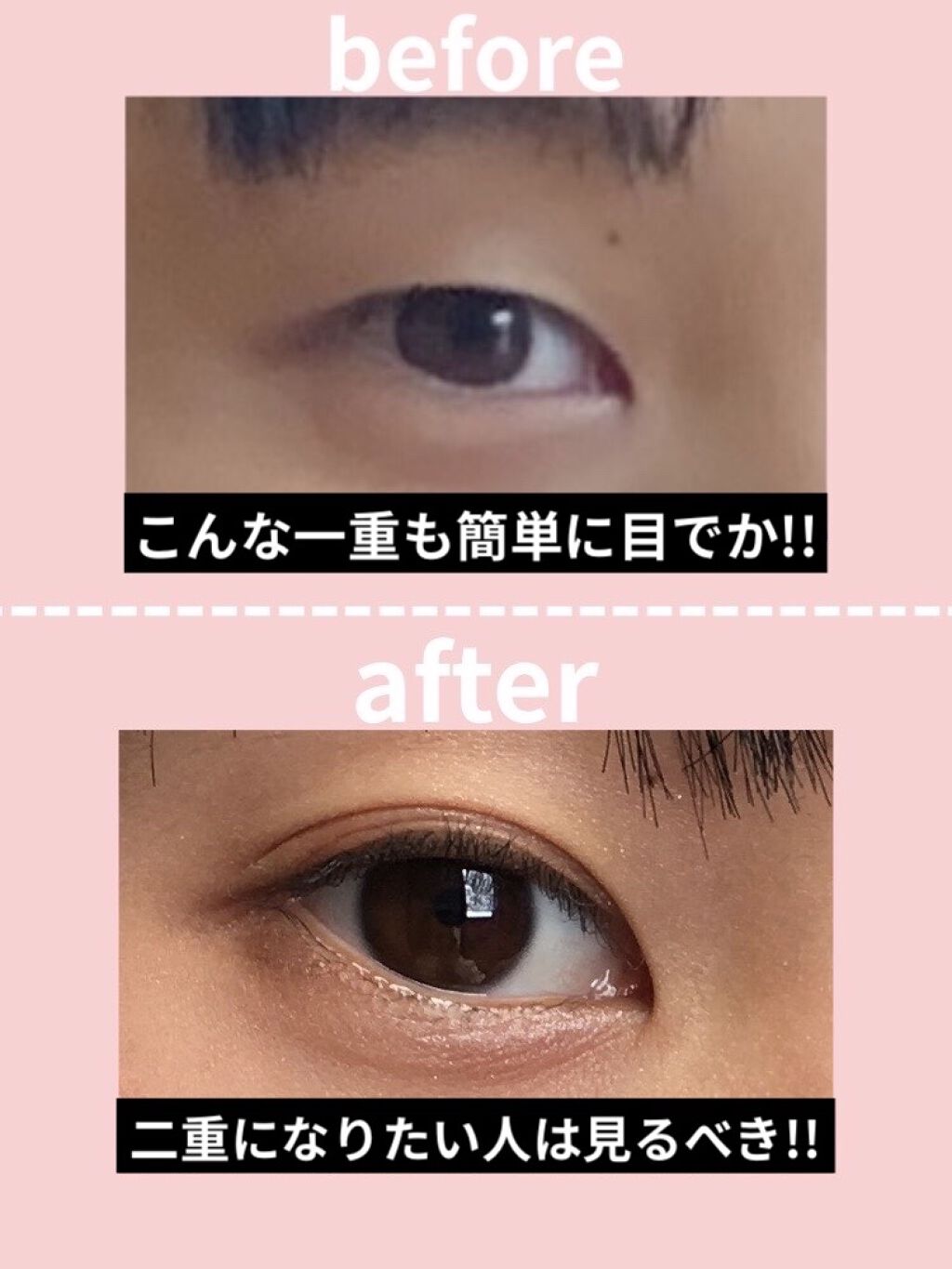 アイトーク/アイトーク/二重まぶた用アイテムを使ったクチコミ（1枚目）