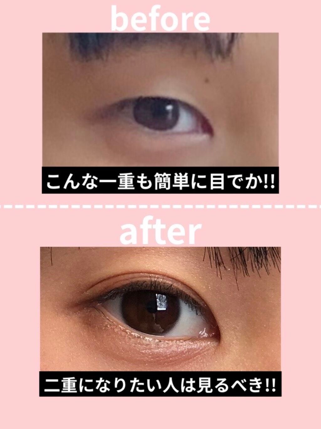 アイトーク/アイトーク/二重まぶた用アイテムを使ったクチコミ(1枚目)