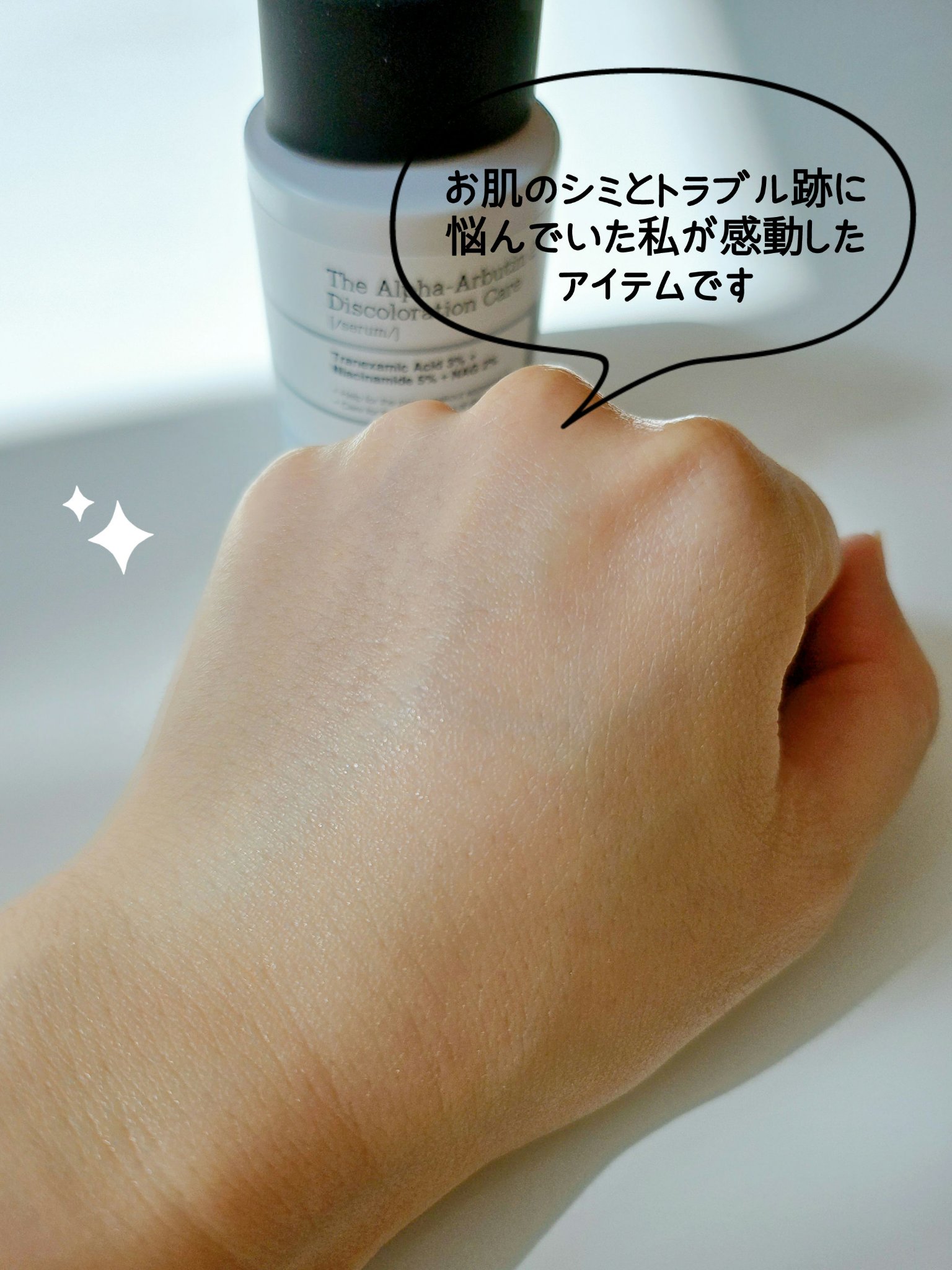 RXザ・アルファアルブチン2 ニキビ跡ケアセラム/COSRX/美容液を使ったクチコミ（3枚目）