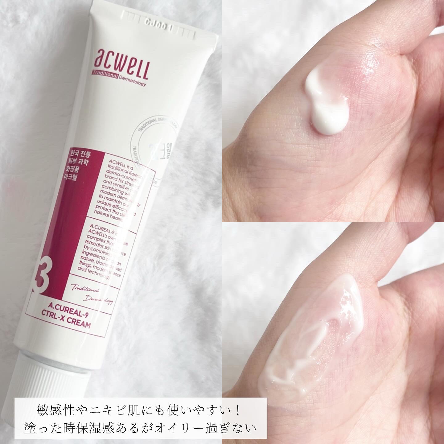 アキュリアルナインコントロールエックスクリーム/ACWELL/フェイスクリームを使ったクチコミ（2枚目）