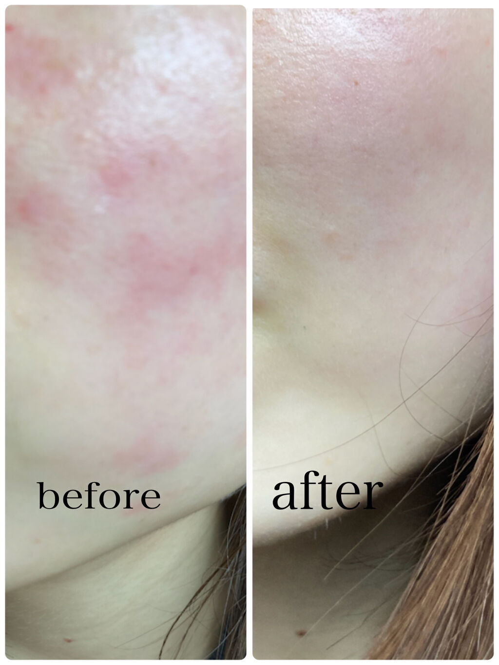 ミノン アミノモイスト モイストチャージ ミルク/ミノン/乳液を使ったクチコミ（3枚目）