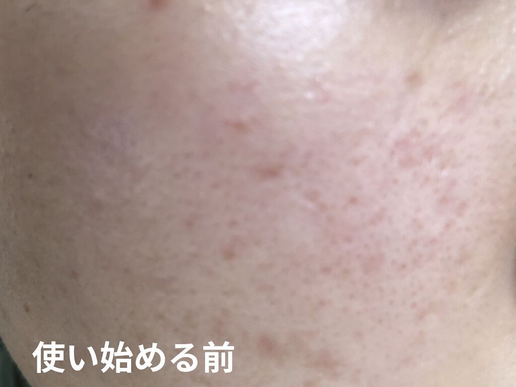 ガラクナイアシン2.0エッセンス/manyo/美容液を使ったクチコミ（2枚目）