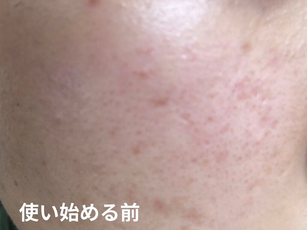 ガラクナイアシン2.0エッセンス/manyo/美容液を使ったクチコミ(2枚目)