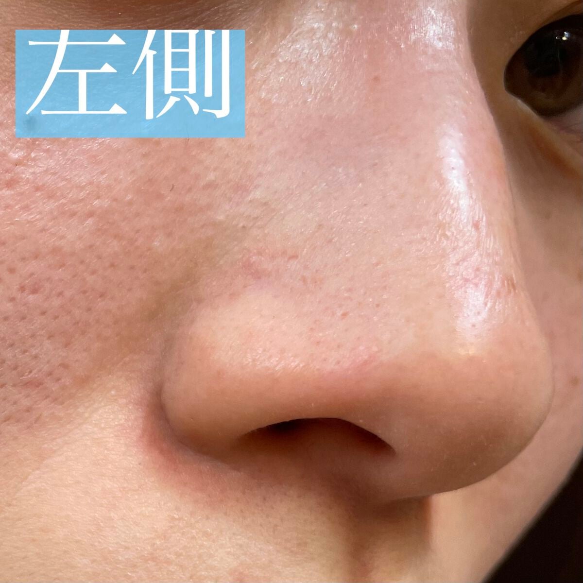 エスト クラリファイイング ジェル ウォッシュ/est/その他洗顔料を使ったクチコミ(3枚目)